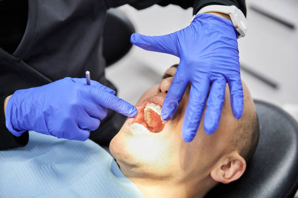 Best Emergency Wisdom Tooth Extraction in Chicago, IL